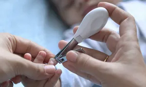 Bé sơ sinh suýt mất mạng bởi vết cắt móng tay nhiễm trùng Bé sơ sinh suýt mất mạng bởi vết cắt móng tay nhiễm trùng